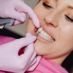 Qu’est-ce qu’une facette dentaire ?